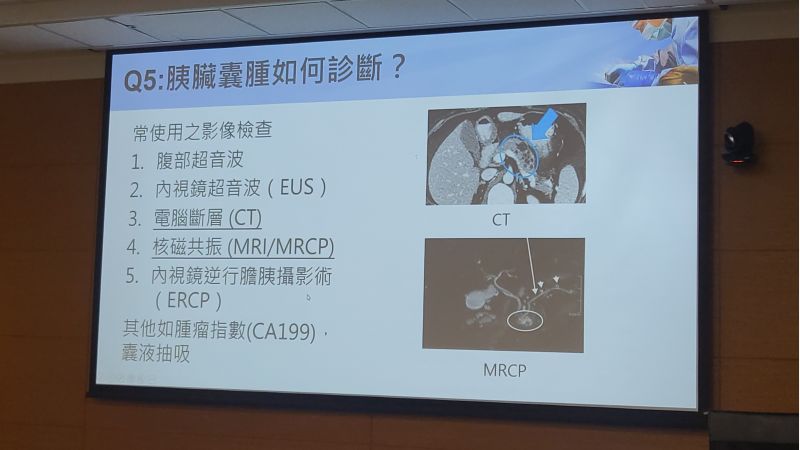 成大醫院一般外科呂維勛醫師分享 解密胰臟囊腫:如何診斷和治療? 圖片來源:記者林清雲 成大醫院一般外科呂維勛醫師分享 解密胰臟囊腫:如何診斷和治療? 圖片來源:記者林清雲