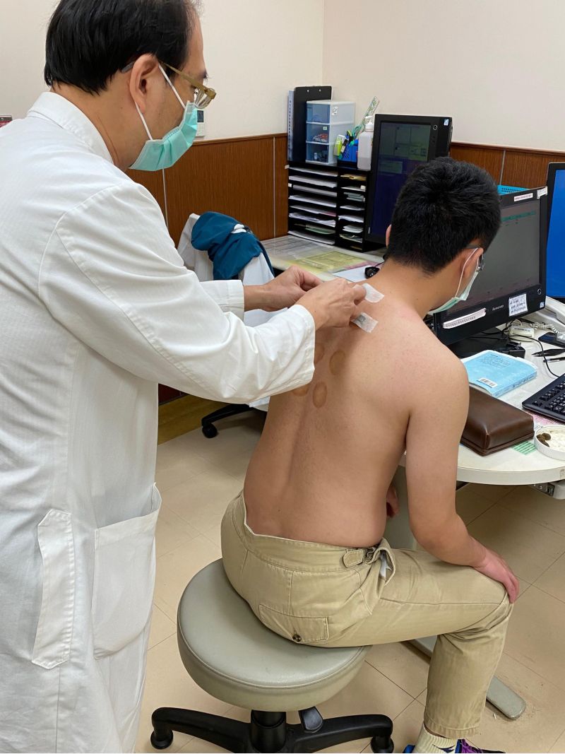 三伏貼主要用於治療過敏性疾病,對於改善新冠患者生活品質亦有幫助。 三伏貼主要用於治療過敏性疾病,對於改善新冠患者生活品質亦有幫助。