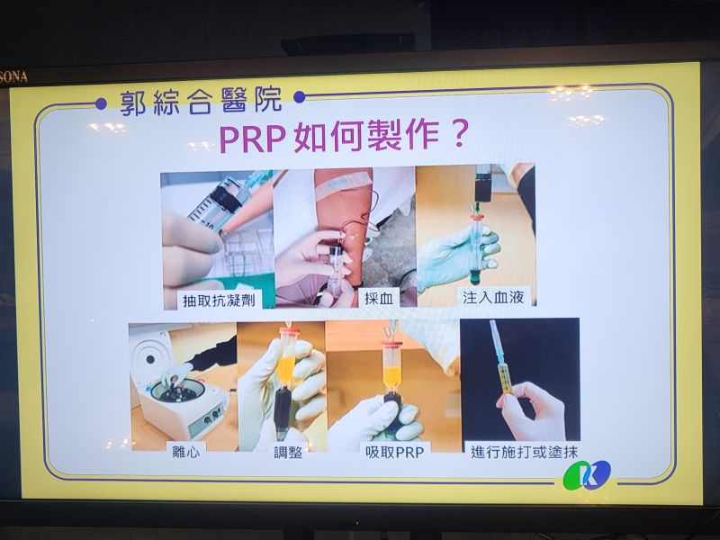 高濃度血小板血高漿PRP---促進困難及慢性能傷口癒合 郭綜合醫院整型外科主任/陳振琨主治 圖片來源:記者林清雲 高濃度血小板血高漿PRP---促進困難及慢性能傷口癒合 郭綜合醫院整型外科主任/陳振琨主治 圖片來源:記者林清雲
