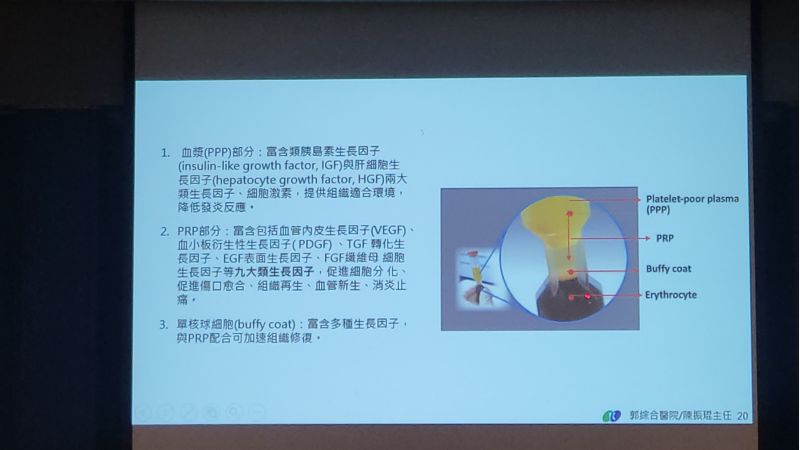 高濃度血小板血高漿PRP---促進困難及慢性能傷口癒合 郭綜合醫院整型外科主任/陳振琨主治 圖片來源:記者林清雲 高濃度血小板血高漿PRP---促進困難及慢性能傷口癒合 郭綜合醫院整型外科主任/陳振琨主治 圖片來源:記者林清雲
