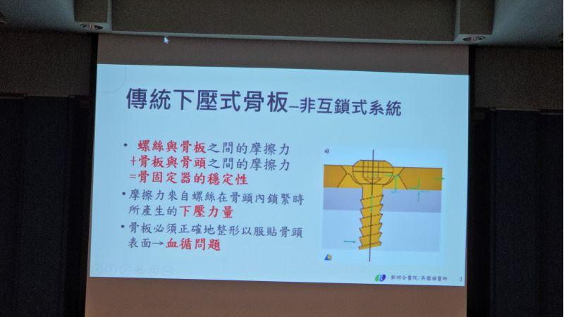 郭綜合醫院骨科主任 吳國禎主治醫師分享 圖片來源:記者 林清雲 攝 郭綜合醫院骨科主任 吳國禎主治醫師分享 圖片來源:記者 林清雲 攝
