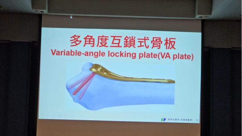 郭綜合醫院骨科主任 吳國禎主治醫師分享 圖片來源:記者 林清雲 攝 郭綜合醫院骨科主任 吳國禎主治醫師分享 圖片來源:記者 林清雲 攝