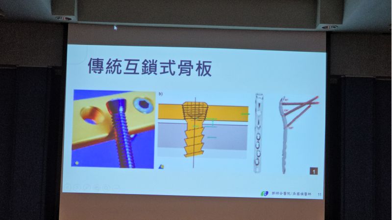 郭綜合醫院骨科主任 吳國禎主治醫師分享 圖片來源:記者 林清雲 攝 郭綜合醫院骨科主任 吳國禎主治醫師分享 圖片來源:記者 林清雲 攝