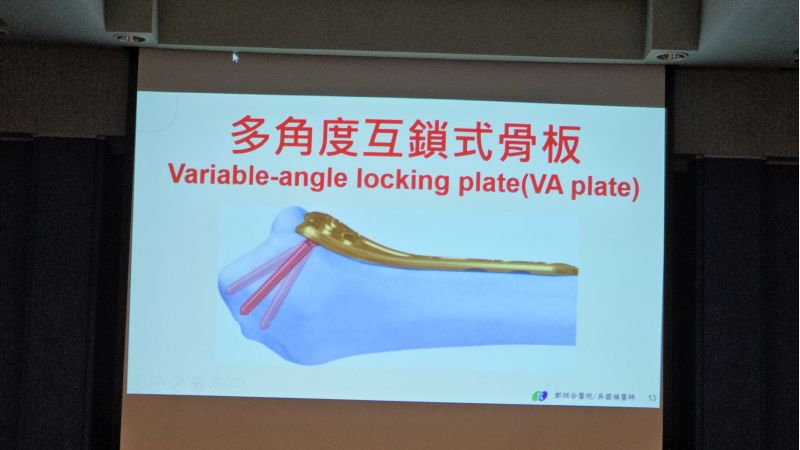郭綜合醫院骨科主任 吳國禎主治醫師分享 圖片來源:記者 林清雲 攝 郭綜合醫院骨科主任 吳國禎主治醫師分享 圖片來源:記者 林清雲 攝