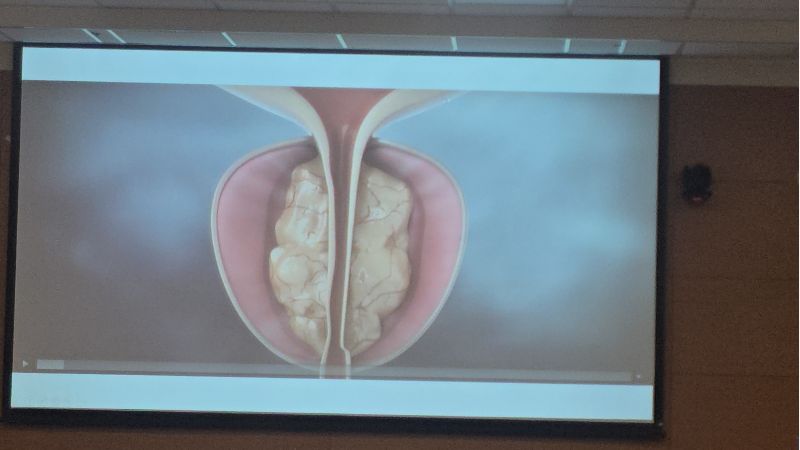 成大醫院泌尿部謝宜珈醫師分享案例  圖片來源：記者林清雲攝